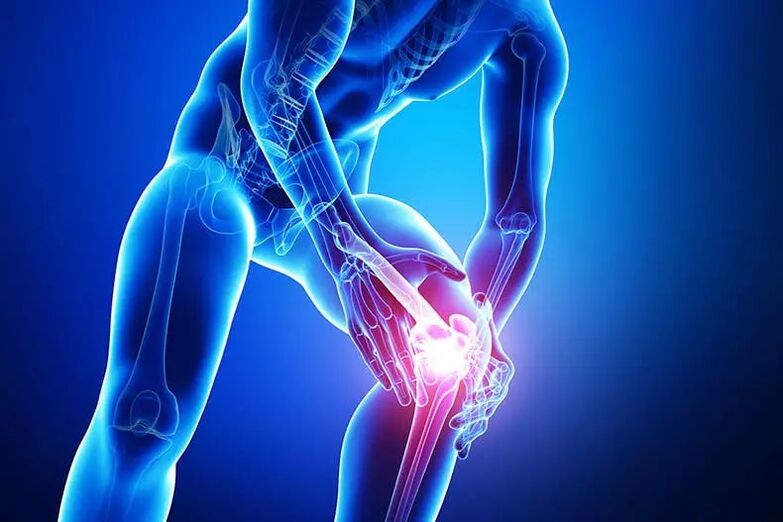 Síntomas da osteoartrite