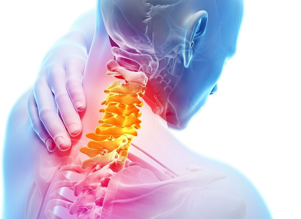 Osteocondrose da columna cervical